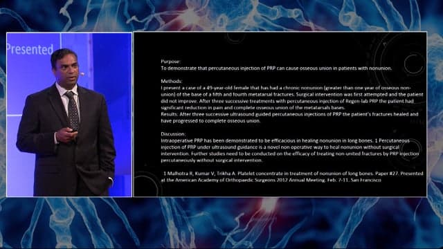 Dr. Albert at a lectern beside a conference slide summarizing a study of PRP for healing bone.