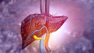 Uncovering the Silent Epidemic: Non-Alcoholic Fatty Liver Disease