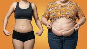 The Dangerous Truth About Belly Fat: Why It's More Than Just a Cosmetic Issue