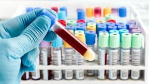 Interpreting Lab Tests and Patient Health Histories to Gain Insight