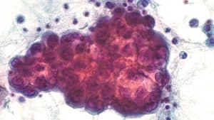 Harnessing Autophagy to Combat Cancer and Neurodegenerative Disease