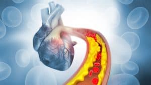 Optimizing Cholesterol Management: A Closer Look at Statins, Ezetimibe, Fibrates and Emerging Therapies