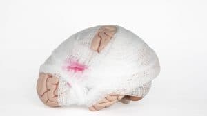 Reframing Our Understanding of Concussions