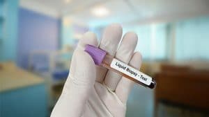 Leveraging Liquid Biopsies to Revolutionize Early Cancer Detection