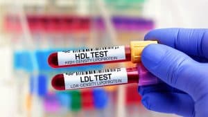The Important Role of Lipoprotein(a) in Heart Health